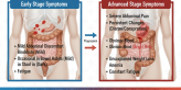 IS Bvs Colon Cancer Symptoms: Key Differences Explained