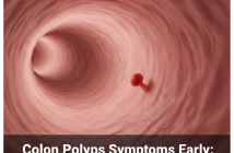 Colon Polyps Symptoms Early: What Most People Miss