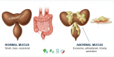 Mucus in Stool Causes: What’s Normal and What’s Not
