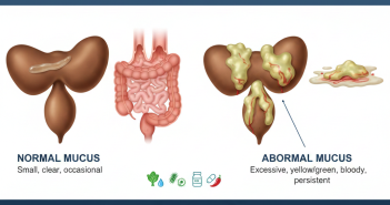 Mucus in Stool Causes: What’s Normal and What’s Not