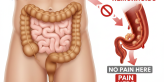 Can Hemorrhoids Cause Colon Pain? Facts Explained