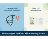 Colonoscopy vs Stool Test: Which Screening Is Better?