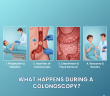 During a Colonoscopy